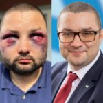 Verprügelt, weil er in der AfD ist